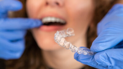 férulas dentales