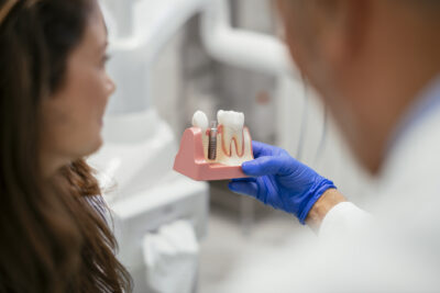 implantes dentales