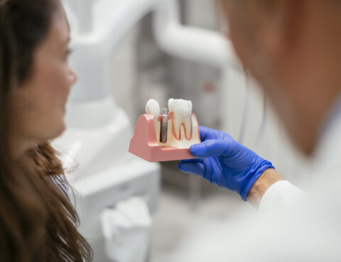 implantes dentales
