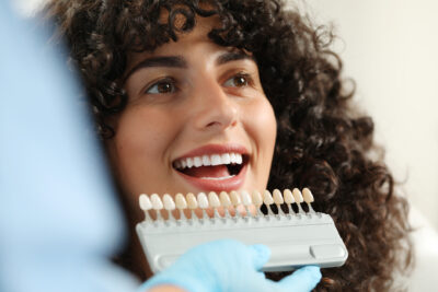 carillas dentales